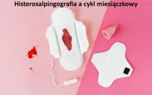 Histerosalpingografia a cykl miesiączkowy, histerosalpingografia, zaburzenia miesiączkowania, cykl menstruacyjny, badanie, zdrowie kobiet