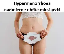 Hypermenorrhoea nadmierne obfite miesiączki 