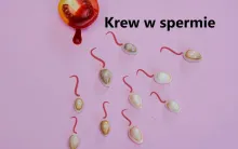 Krew w spermie, krew w nasieniu, PRZYCZYNY KRWI W NASIENIU, SPERMIE