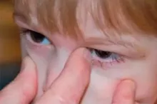 Masaż kanalika łzowego u niemowląt