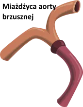 Miażdżyca aorty brzusznej 
