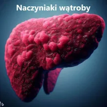 Naczyniak wątroby
