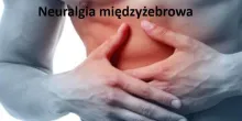 Neuralgia międzyżebrowa 
