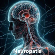 Neuropatia