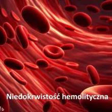 Niedokrwistość hemolityczna, anemia hemolityczna