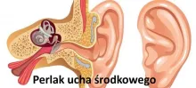 Perlak ucha środkowego