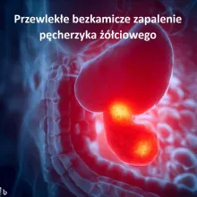 Przewlekłe bezkamicze zapalenie pęcherzyka żółciowego, Przewlekłe niekamicowe zapalenie pęcherzyka żółciowego 