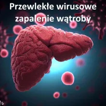 Przewlekłe wirusowe zapalenie wątroby