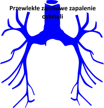 Przewlekłe zanikowe zapalenie oskrzeli 
