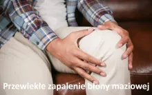 Przewlekłe zapalenie błony maziowej