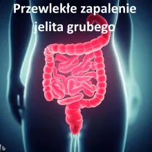 Przewlekłe zapalenie jelita grubego