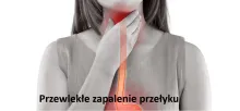 Przewlekłe zapalenie przełyku