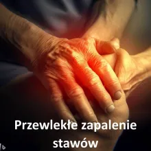 Przewlekłe zapalenie stawów