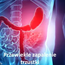Przewlekłe zapalenie trzustki