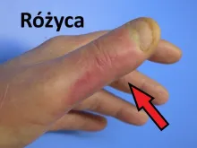 Różyca 