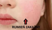 RUMIEŃ ZAKAŹNY