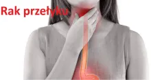 Rak przełyku 