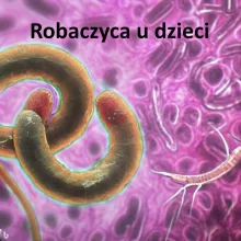 Robaczyca u dzieci