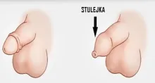 stulejka 