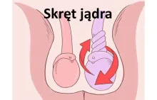 Skręt jądra 