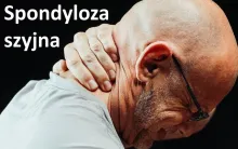 Spondyloza szyjna 