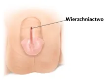 Wierzchniactwo 