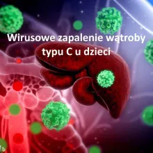 Wirusowe zapalenie wątroby typu C u dzieci
