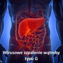 Wirusowe zapalenie wątroby typu G