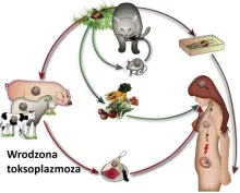 Wrodzona toksoplazmoza 