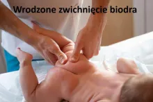 Wrodzone zwichnięcie stawu biodrowego