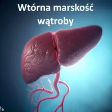 Wtórna marskość wątroby