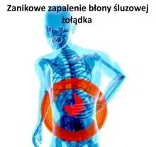 Zanikowe zapalenie błony śluzowej żołądka 