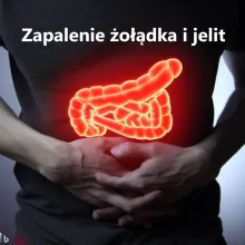 Zapalenie żołądka i jelit