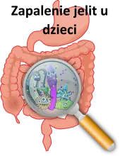 Zapalenie jelit u dzieci