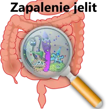 Zapalenie jelit 