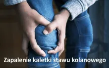 Zapalenie kaletki stawu kolanowego