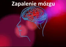 Zapalenie mózgu 