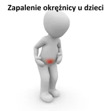 Zapalenie okrężnicy u dzieci