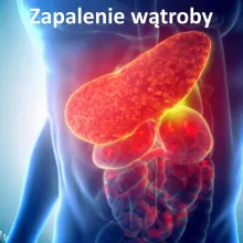 Zapalenie wątroby