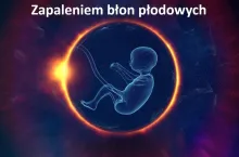 Zapaleniem błon płodowych