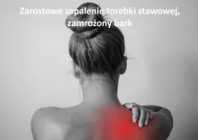 Zarostowe zapalenie torebki stawowej, zamrożony bark 