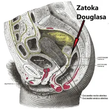 ZATOKA DOUGLASA, ZAGŁĘBIENIE ODBYTNICZO-MACICZNE, ZAGŁĘBIENIE DOUGLASA 