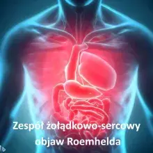 ZESPÓŁ ŻOŁĄDKOWO-SERCOWY, objaw Roemhelda , zespół żołądkowo-sercowy Roemhelda 