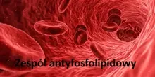 Zespół antyfosfolipidowy 