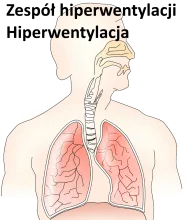 Zespół hiperwentylacji, hiperwentylacja
