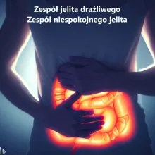 Zespół jelita drażliwego (IBS) Irritable Bowel Syndrome, zespół niespokojnego jelita 