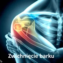 Zwichnięcie barku, wybicie barku