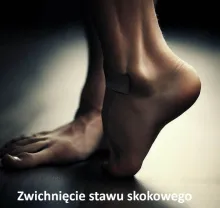 Zwichnięcie stawu skokowego, skręcenie kostki 