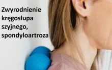 Zwyrodnienie kręgosłupa szyjnego, spondyloartroza 