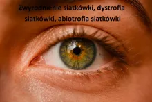 Zwyrodnienie siatkówki, dystrofia siatkówki, abiotrofia siatkówki